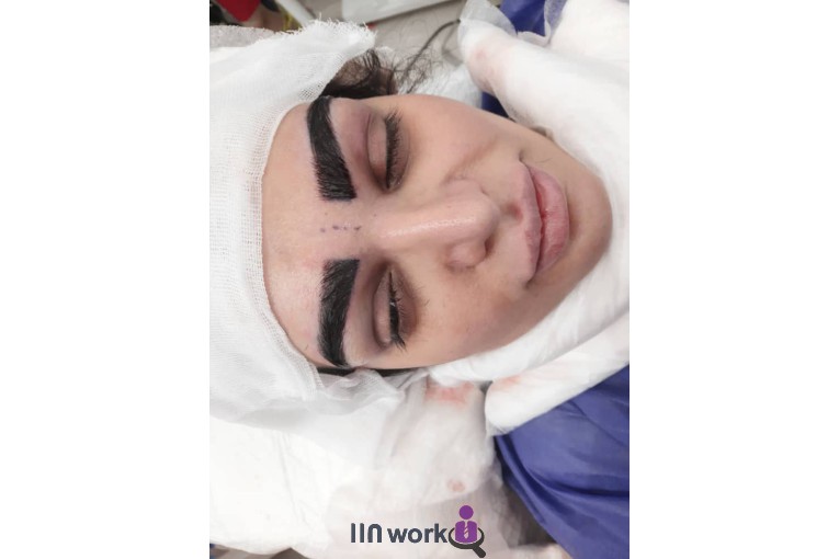 کاشت مو و ابرو امجدیان در کرمانشاه