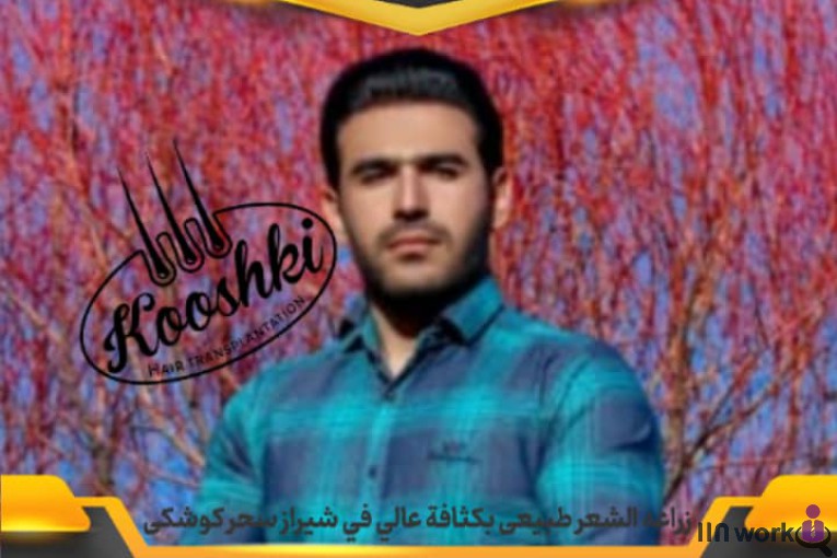 کاشت مو سحر کوشکی در شیراز