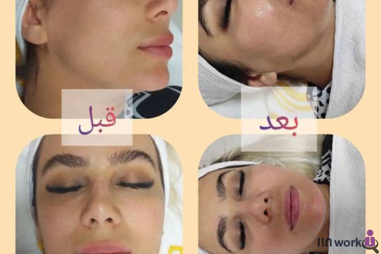 فیشیال ناهید تکاور در تهران