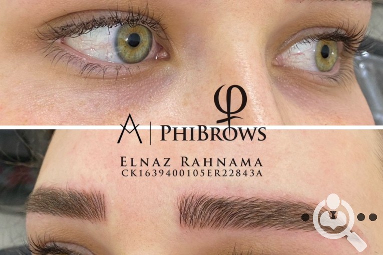فیبروز تخصصی ال ناز رهنما در تبریز