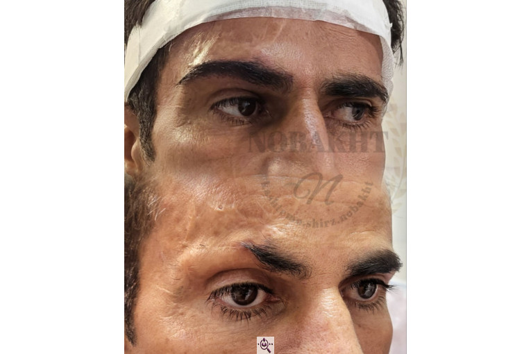 کاشت مو و ابرو تخصصی نوبخت در شیراز