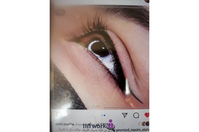 خدمات تخصصی میکرواسکالپ در اصفهان