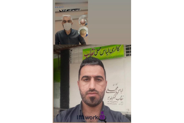 کاشت تخصصی مو و ابرو زهرا ارجمند در شیراز