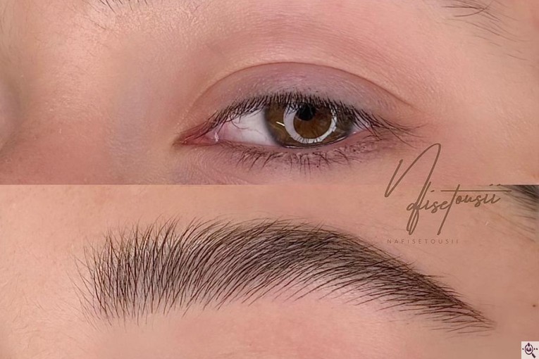 خدمات زیبایی میکرو و فیبروز نفیسه طوسی در مشهد