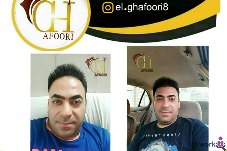 کاشت مو الهام غفوری در شیراز