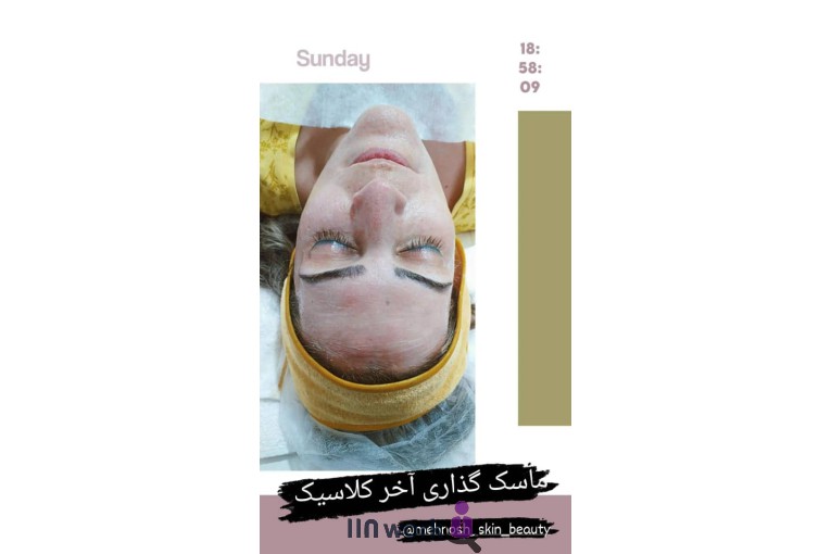 خدمات اسکین کر مهنوش احمدی در اصفهان