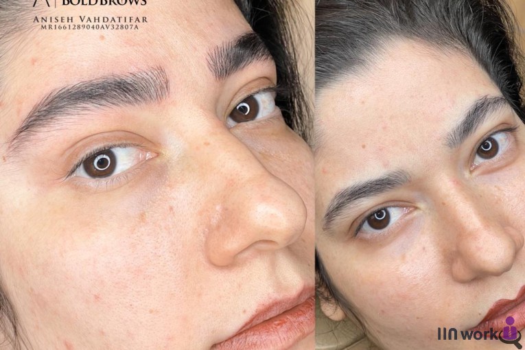 خدمات و آموزش فیبروز انیسه وحدتی فر در عظیمیه کرج