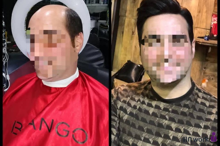 مرکز تخصصی پروتز مو و زیبایی دندی در تبریز