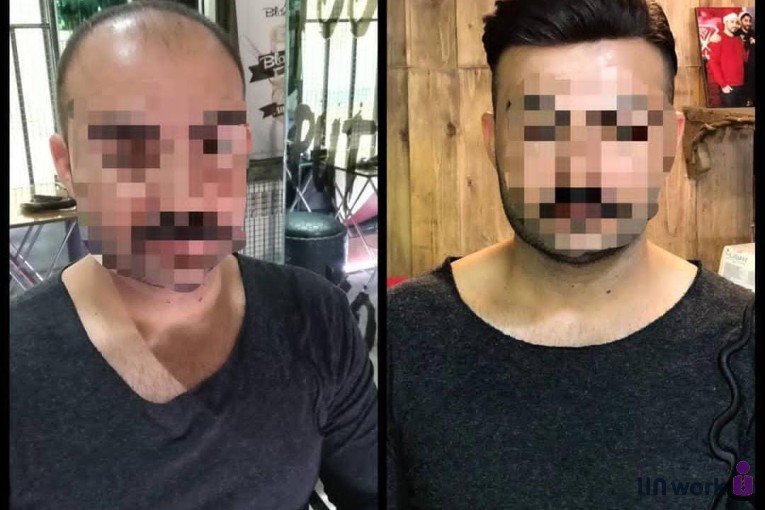 مرکز تخصصی پروتز مو و زیبایی دندی در تبریز
