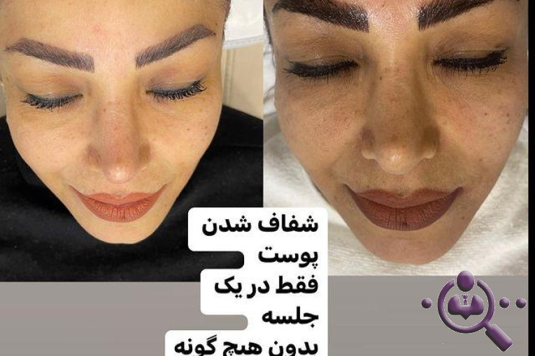 خدمات پوستی نسرین عظیمی در تهران