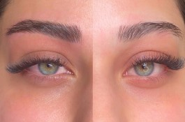 خدمات تخصصی فیبروز زنجان فاطمه محمدی