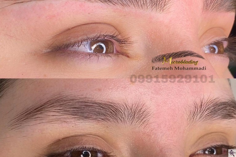 خدمات تخصصی فیبروز زنجان فاطمه محمدی