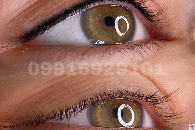 خدمات تخصصی فیبروز زنجان فاطمه محمدی