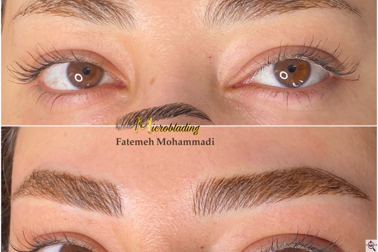 خدمات تخصصی فیبروز زنجان فاطمه محمدی