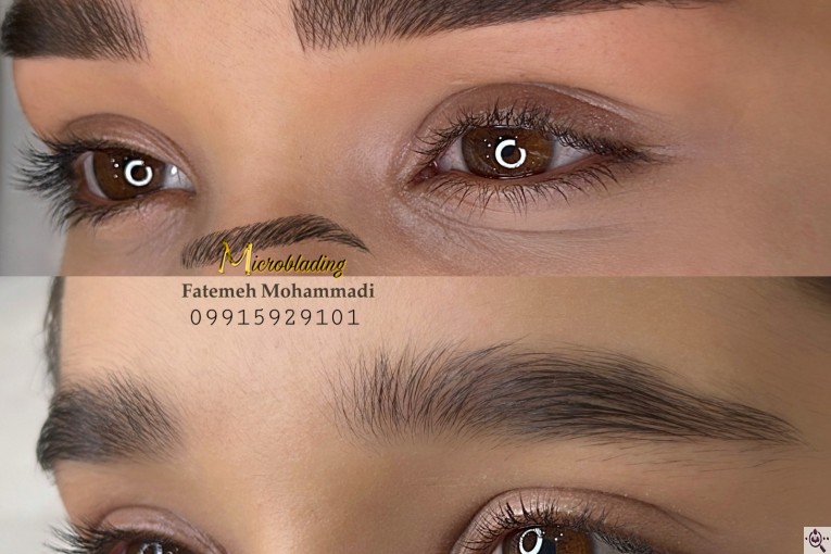 خدمات تخصصی فیبروز زنجان فاطمه محمدی