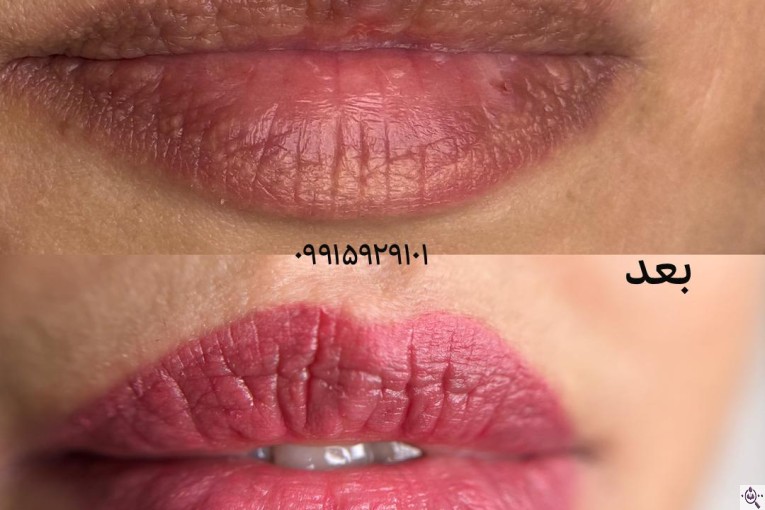 خدمات تخصصی فیبروز زنجان فاطمه محمدی